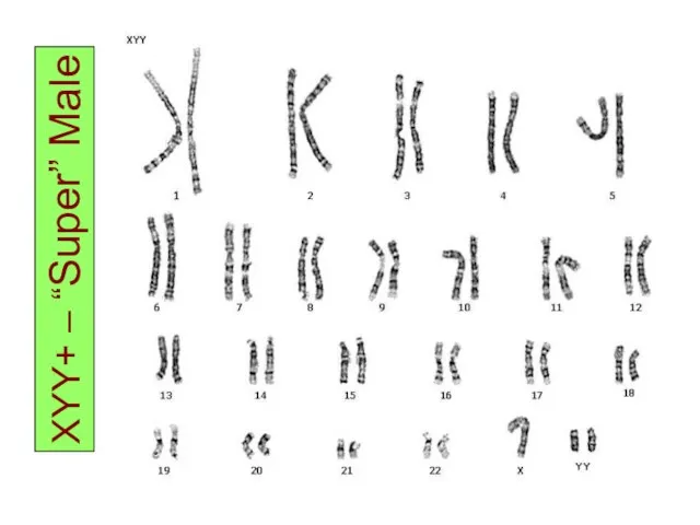 XYY+ – “Super” Male