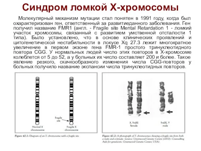 Синдром ломкой Х-хромосомы Молекулярный механизм мутации стал понятен в 1991 году,