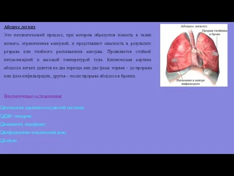 Абсцесс легких Это патологический процесс, при котором образуется полость в ткани