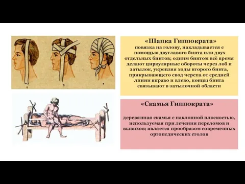 «Шапка Гиппократа» повязка на голову, накладывается с помощью двуглавого бинта или