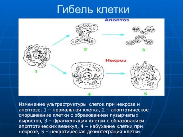 Гибель клетки Изменение ультраструктуры клеток при некрозе и апоптозе. 1 –