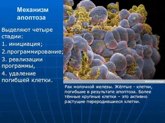 Механизм апоптоза Выделяют четыре стадии: 1. инициация; 2.программирование; 3. реализации программы,