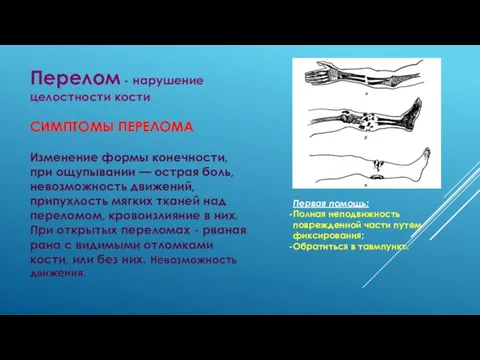 Перелом - нарушение целостности кости СИМПТОМЫ ПЕРЕЛОМА Изменение формы конечности, при