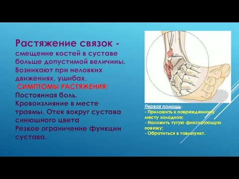 Растяжение связок - смещение костей в суставе больше допустимой величины. Возникают