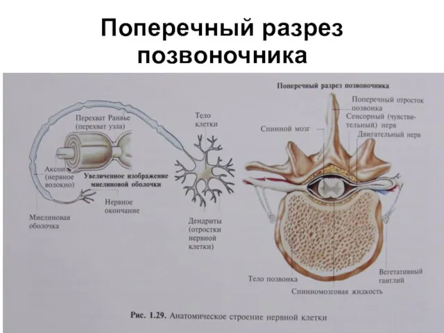 Поперечный разрез позвоночника