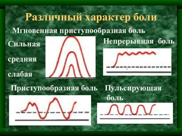 Различный характер боли Мгновенная приступообразная боль Сильная средняя слабая Приступообразная боль Непрерывная боль Пульсирующая боль