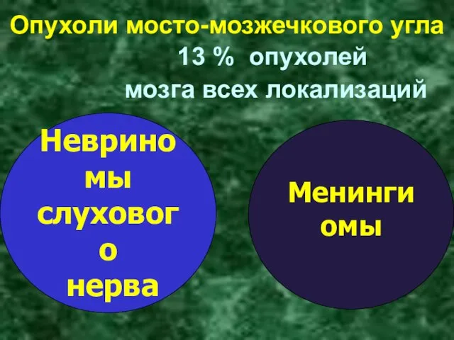 Опухоли мосто-мозжечкового угла Невриномы слухового нерва Менингиомы 13 % опухолей мозга всех локализаций