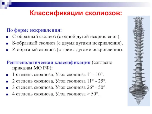 Классификации сколиозов: По форме искривления: С-образный сколиоз (с одной дугой искривления).