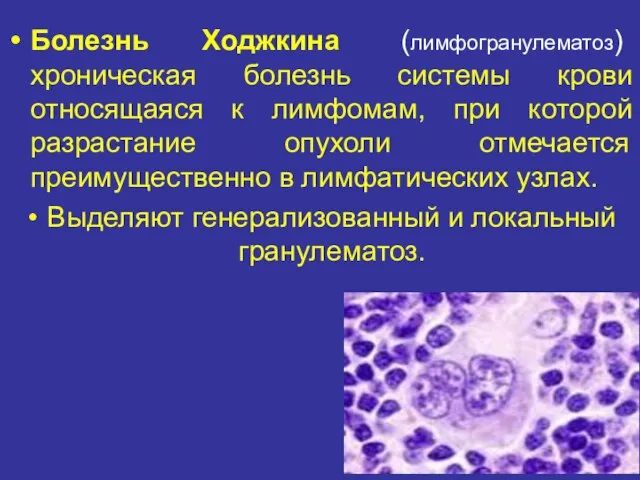 Болезнь Ходжкина (лимфогранулематоз) хроническая болезнь системы крови относящаяся к лимфомам, при