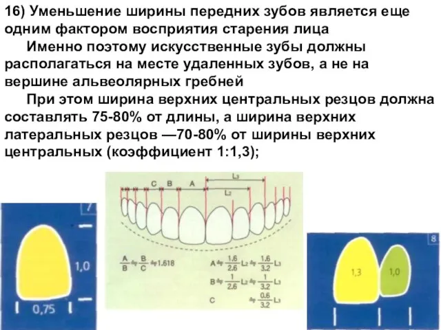 16) Уменьшение ширины передних зубов является еще одним фактором восприятия старения