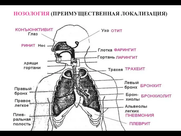 НОЗОЛОГИЯ (ПРЕИМУЩЕСТВЕННАЯ ЛОКАЛИЗАЦИЯ)