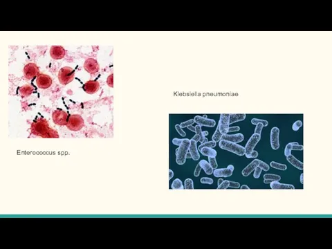 Enterococcus spp. Klebsiella pneumoniae