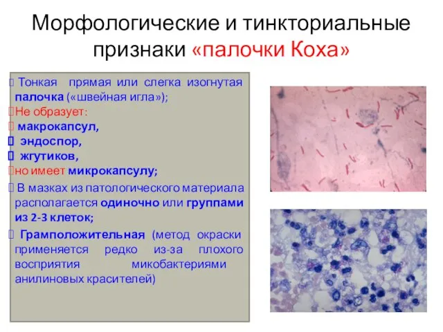 Морфологические и тинкториальные признаки «палочки Коха» Тонкая прямая или слегка изогнутая