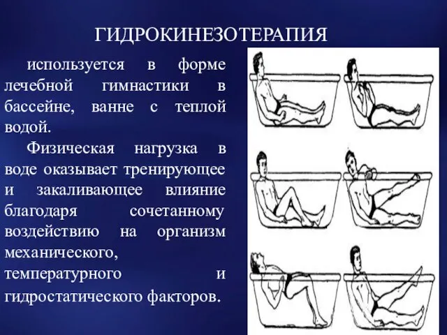 ГИДРОКИНЕЗОТЕРАПИЯ используется в форме лечебной гимнастики в бассейне, ванне с теплой