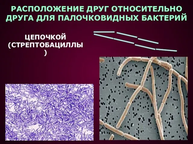 РАСПОЛОЖЕНИЕ ДРУГ ОТНОСИТЕЛЬНО ДРУГА ДЛЯ ПАЛОЧКОВИДНЫХ БАКТЕРИЙ ЦЕПОЧКОЙ (СТРЕПТОБАЦИЛЛЫ)