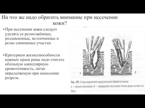 На что же надо обратить внимание при иссечении кожи? При иссечении