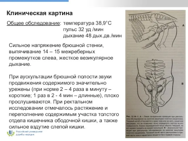 Клиническая картина Общее обследование: температура 38,9°С пульс 32 уд /мин дыхание