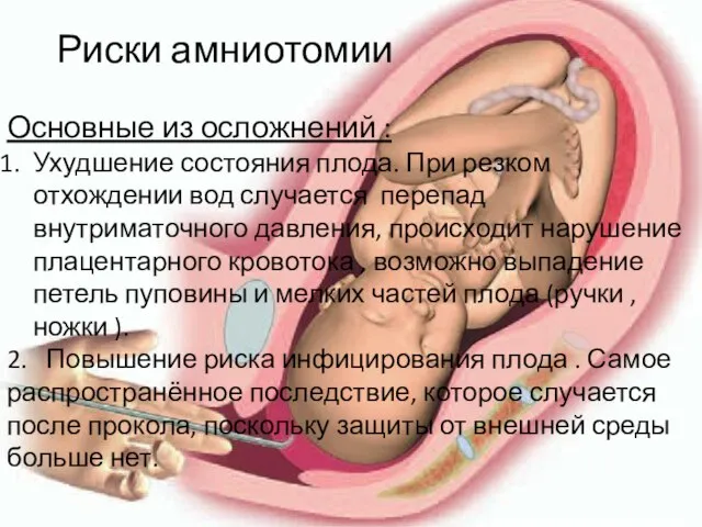 Риски амниотомии Основные из осложнений : Ухудшение состояния плода. При резком