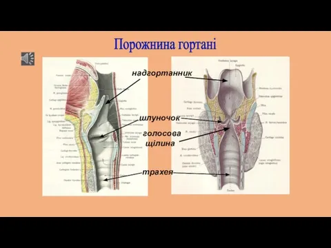 Порожнина гортані голосова щілина надгортанник трахея шлуночок