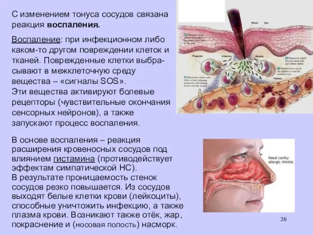 С изменением тонуса сосудов связана реакция воспаления. Воспаление: при инфекционном либо