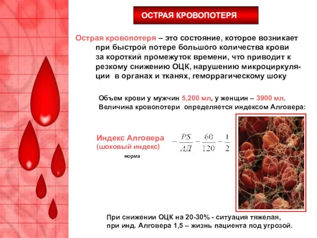 Острая кровопотеря – это состояние, которое возникает при быстрой потере большого