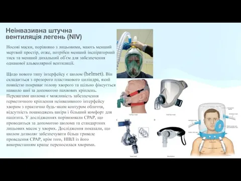 Неінвазивна штучна вентиляція легень (NIV) Носові маски, порівняно з лицьовими, мають