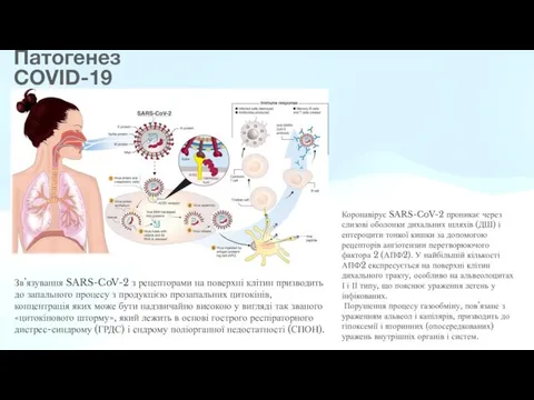 Патогенез COVID-19 Коронавірус SARS-CoV-2 проникає через слизові оболонки дихальних шляхів (ДШ)