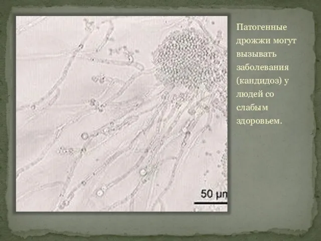 Патогенные дрожжи могут вызывать заболевания (кандидоз) у людей со слабым здоровьем.