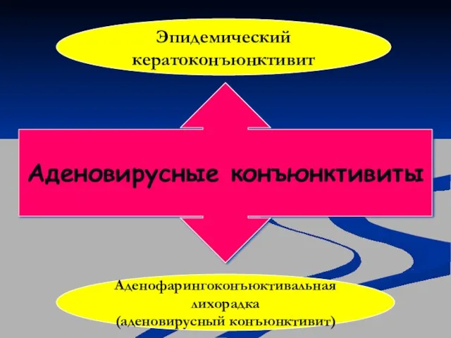 Аденовирусные конъюнктивиты Аденофарингоконъюктивальная лихорадка (аденовирусный конъюнктивит) Эпидемический кератоконъюнктивит