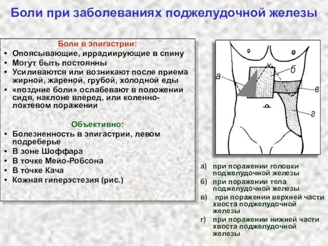 Боли при заболеваниях поджелудочной железы а) при поражении головки поджелудочной железы