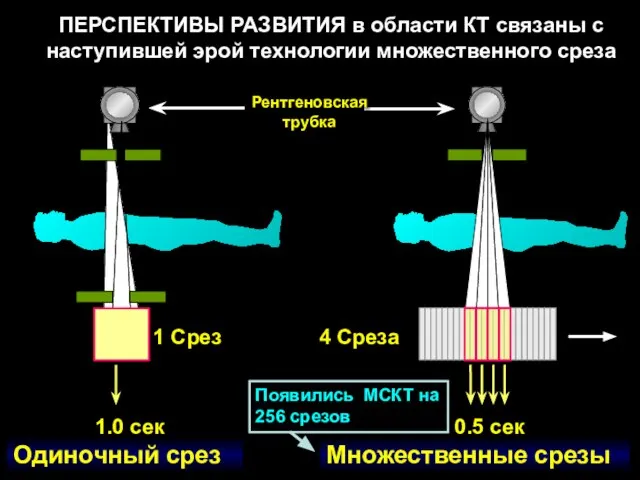 Множественные срезы Одиночный срез 4 Среза 1 Срез Рентгеновская трубка ПЕРСПЕКТИВЫ