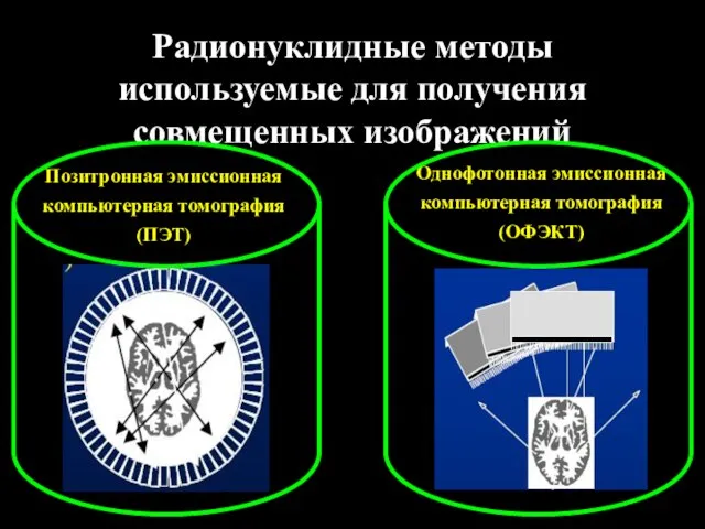 Радионуклидные методы используемые для получения совмещенных изображений Позитронная эмиссионная компьютерная томография