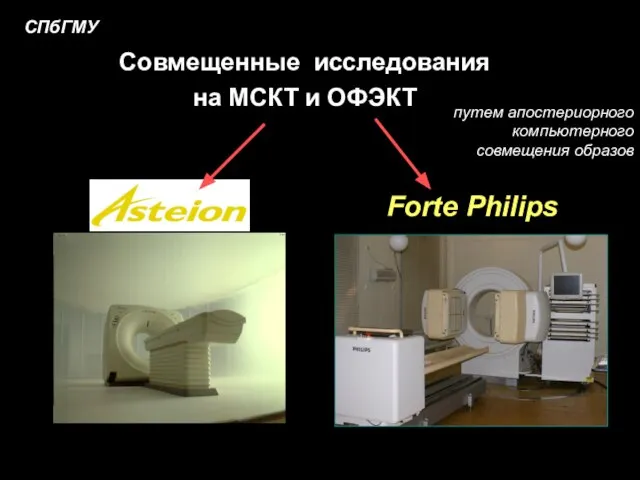 Forte Philips СПбГМУ Совмещенные исследования на МСКТ и ОФЭКТ путем апостериорного компьютерного совмещения образов