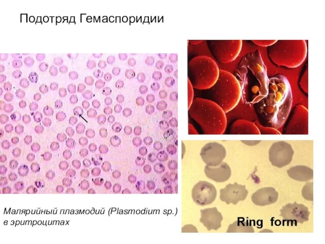 Подотряд Гемаспоридии Малярийный плазмодий (Plasmodium sp.) в эритроцитах