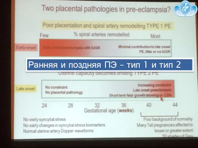 Ранняя и поздняя ПЭ – тип 1 и тип 2