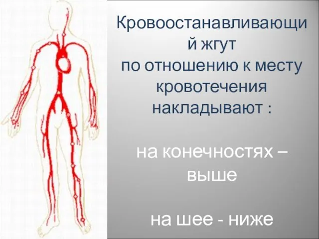 Кровоостанавливающий жгут по отношению к месту кровотечения накладывают : на конечностях