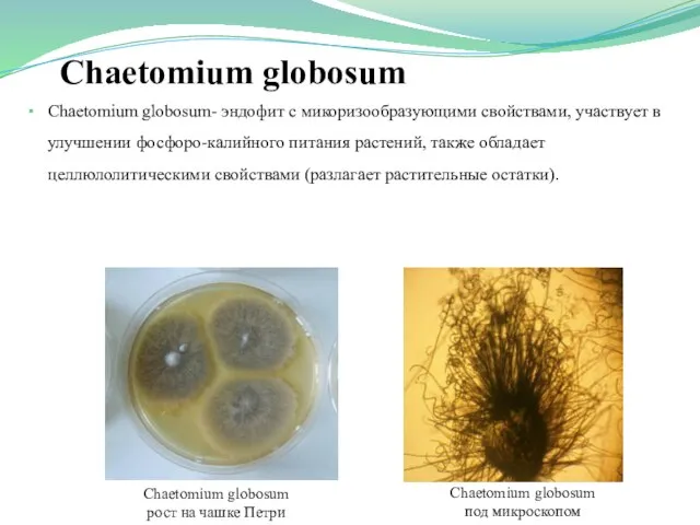 Chaetomium globosum Chaetomium globosum рост на чашке Петри Chaetomium globosum под