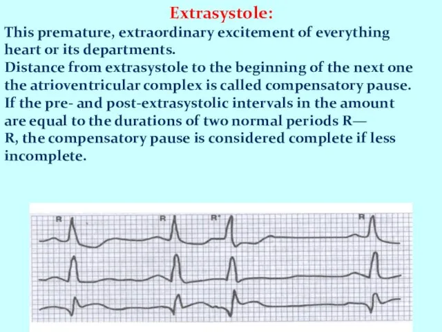 Extrasystole: This premature, extraordinary excitement of everything heart or its departments.