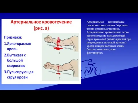 Артериальное — вид наиболее опасного кровотечения. Угрожает жизни организма человека. Артериальное