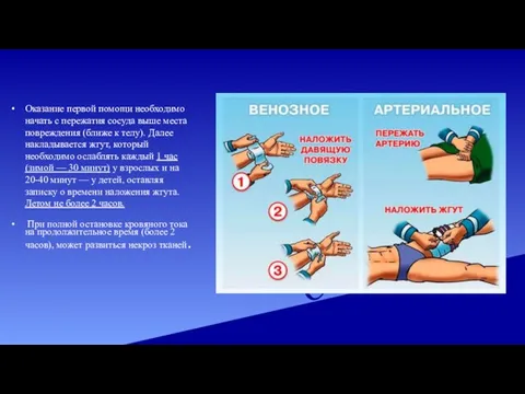 Оказание первой помощи необходимо начать с пережатия сосуда выше места повреждения