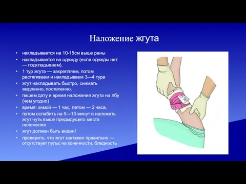 Наложение жгута накладывается на 10-15см выше раны накладывается на одежду (если