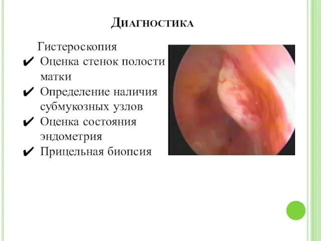 Диагностика Гистероскопия Оценка стенок полости матки Определение наличия субмукозных узлов Оценка состояния эндометрия Прицельная биопсия