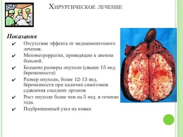 Хирургическое лечение Показания Отсутствие эффекта от медикаментозного лечения. Менометроррагии, приводящие к