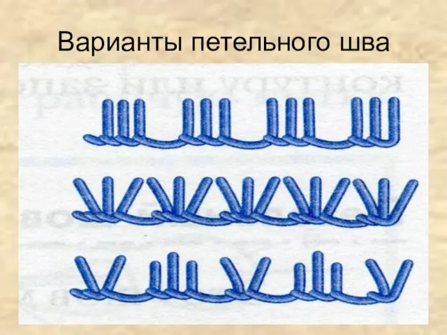 Варианты петельного шва