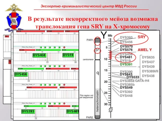 В результате некорректного мейоза возможна транслокация гена SRY на X-хромосому