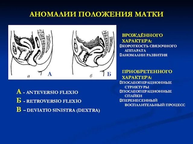 АНОМАЛИИ ПОЛОЖЕНИЯ МАТКИ A - ANTEVERSIO FLEXIO Б - RETROVERSIO FLEXIO