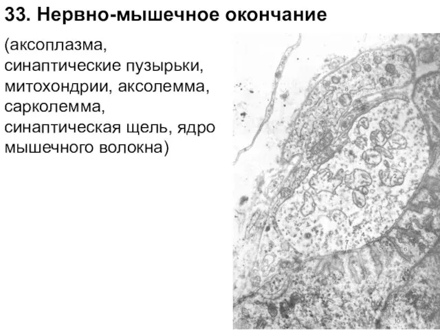 (аксоплазма, синаптические пузырьки, митохондрии, аксолемма, сарколемма, синаптическая щель, ядро мышечного волокна) 33. Нервно-мышечное окончание