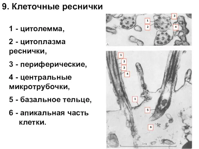 1 - цитолемма, 2 - цитоплазма реснички, 3 - периферические, 4