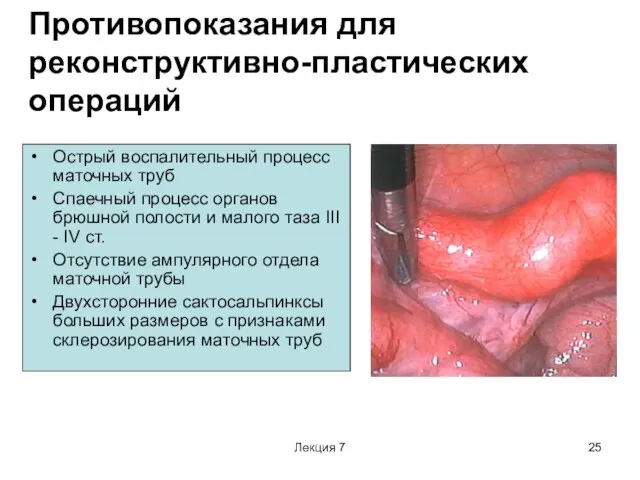 Лекция 7 Противопоказания для реконструктивно-пластических операций Острый воспалительный процесс маточных труб