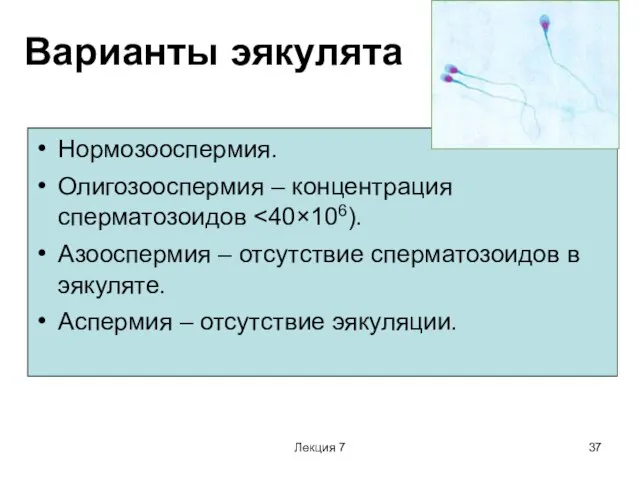 Лекция 7 Варианты эякулята Нормозооспермия. Олигозооспермия – концентрация сперматозоидов Азооспермия –